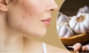 Garlic Effect on Face